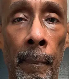 Real patient results in San Diego, CA