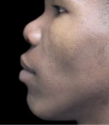 Real patient results in San Diego, CA Tiffany Pham MD Before and After