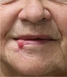 Real patient results in San Diego, CA Tiffany Pham MD Before and After