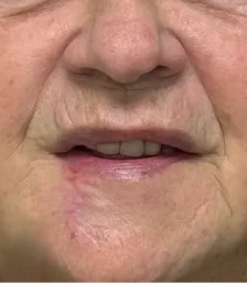 Real patient results in San Diego, CA Tiffany Pham MD Before and After