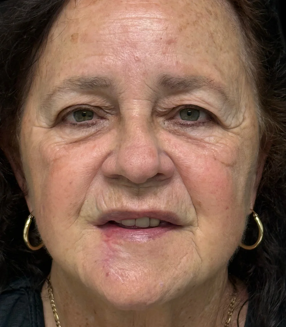 Real patient results in San Diego, CA Tiffany Pham MD Before and After