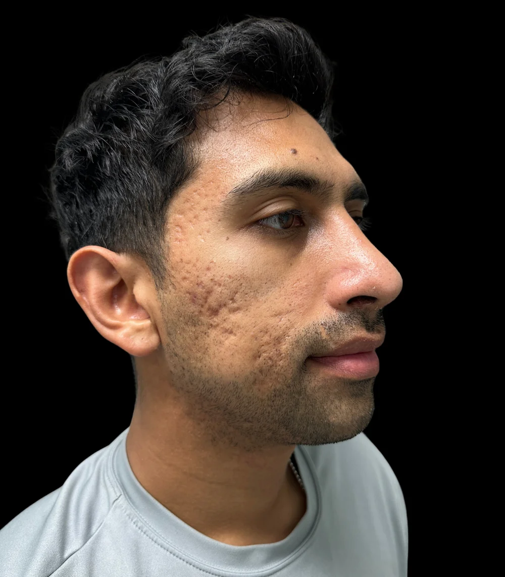 Real patient results in San Diego, CA Tiffany Pham MD Before and After