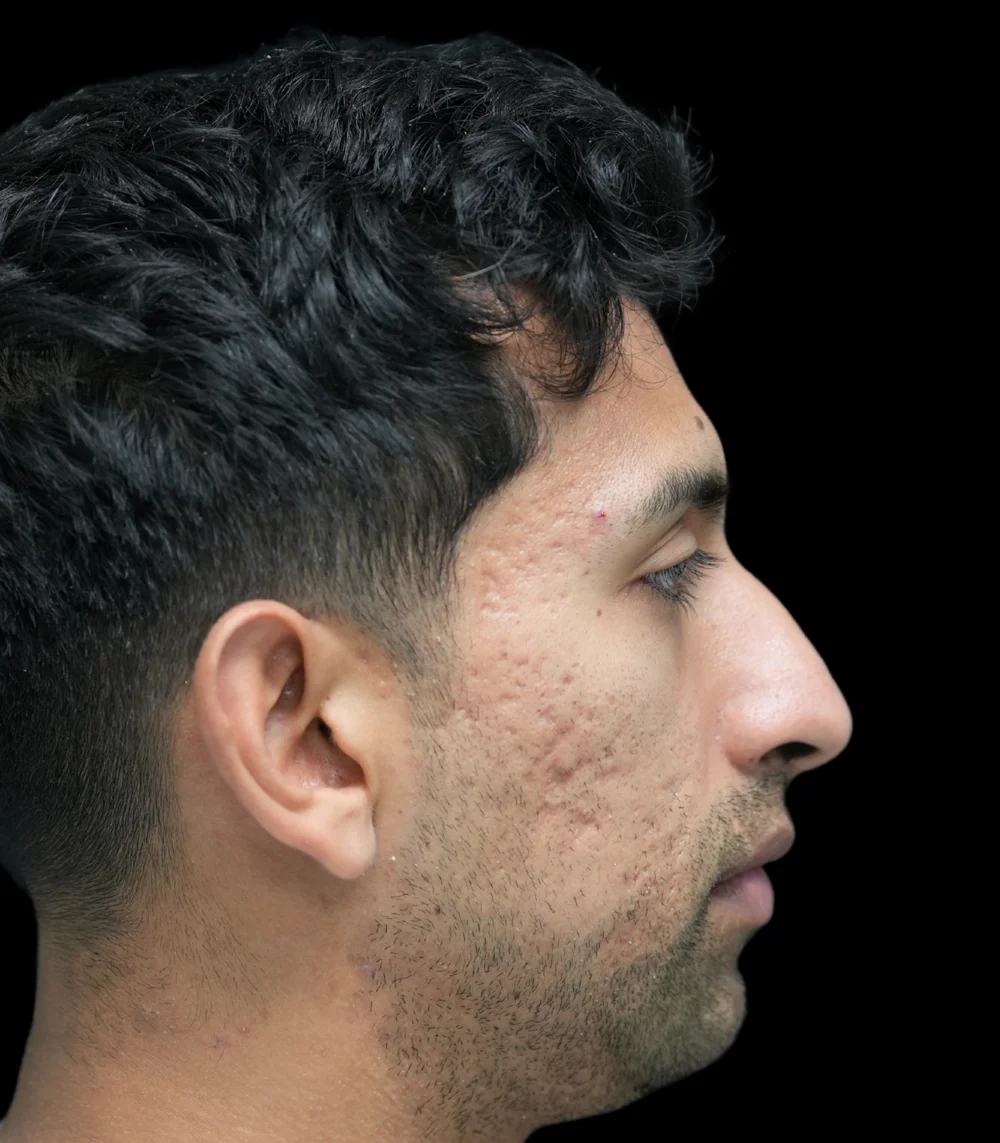Real patient results in San Diego, CA Tiffany Pham MD Before and After