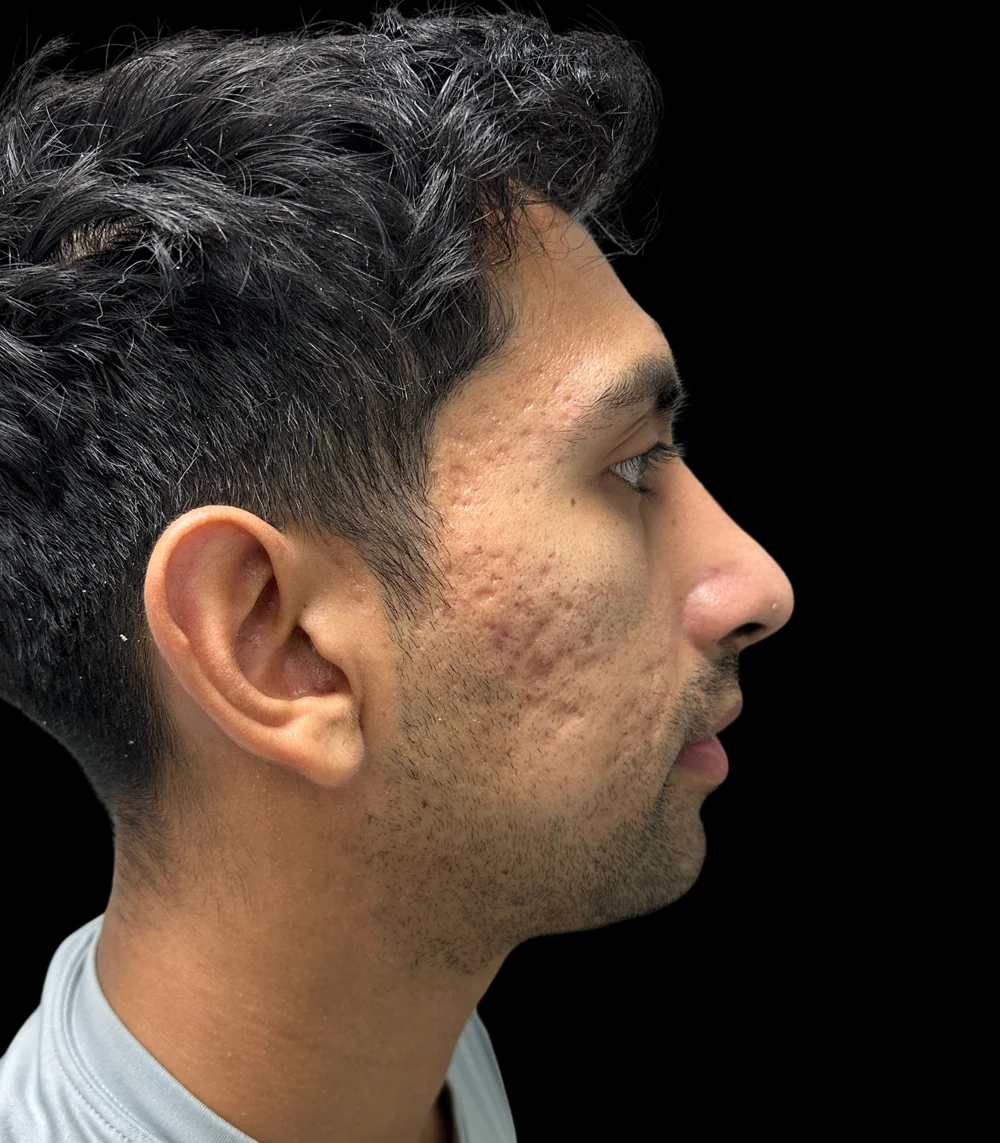 Real patient results in San Diego, CA Tiffany Pham MD Before and After