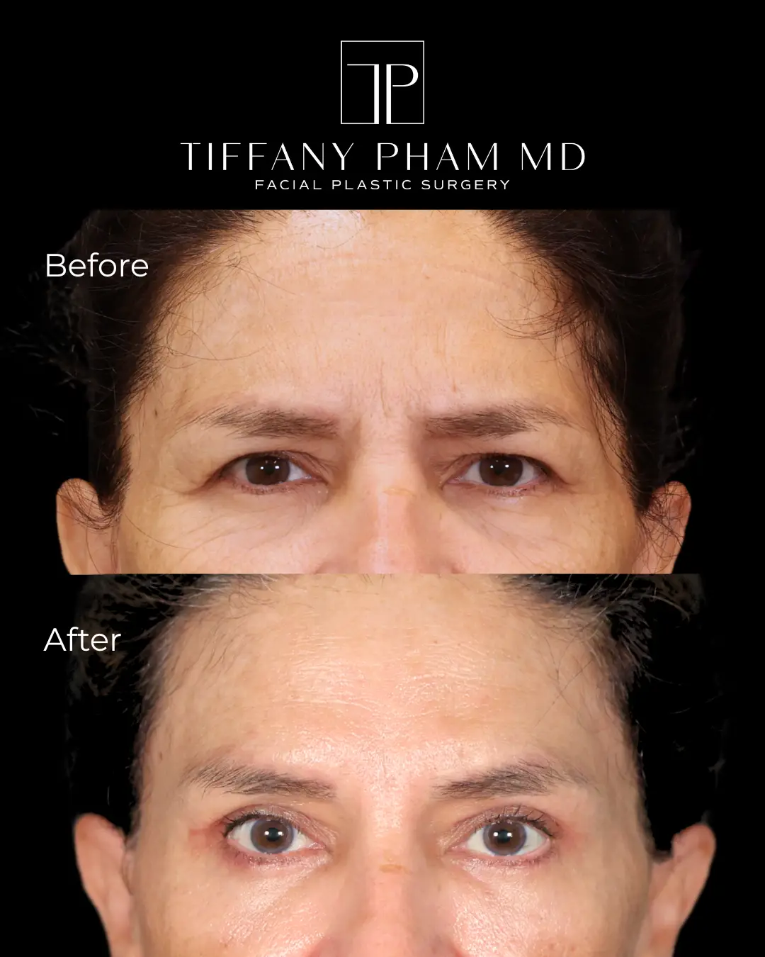 brow1